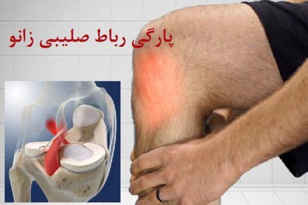 پارگی رباط صلیبی قدامی
