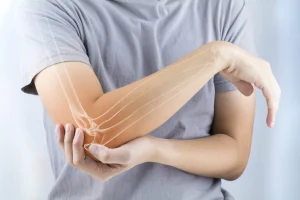 دررفتگی آرنج